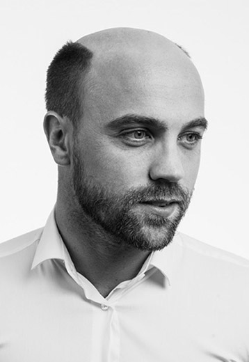 Découvrez Hairskeen, des solutions innovantes et invisibles pour retrouver ses cheveux en 1h seulement Calvitie avant complément capillaire Hairskeen